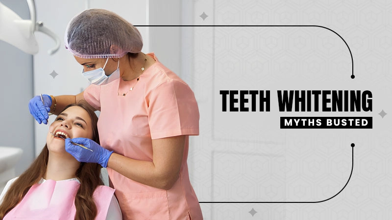 teeth whitening myths busted